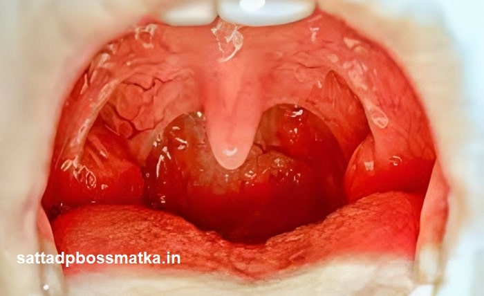 can tonsils grow back